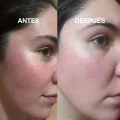 Pack "Ecodermik" By Salad Code -Cliomakeup Shop IMAGENES WEB CORRECTA 2025 3 1