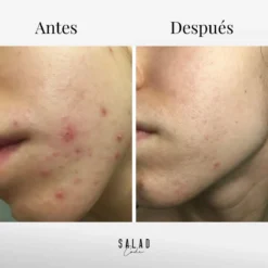Pack Acne Balance -Cliomakeup Shop Mencionadoen 1 1