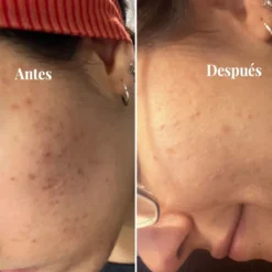 Sérum Iluminador Antimanchas 15 Sérum Iluminador Antimanchas -Cliomakeup Shop SaladCodeBA