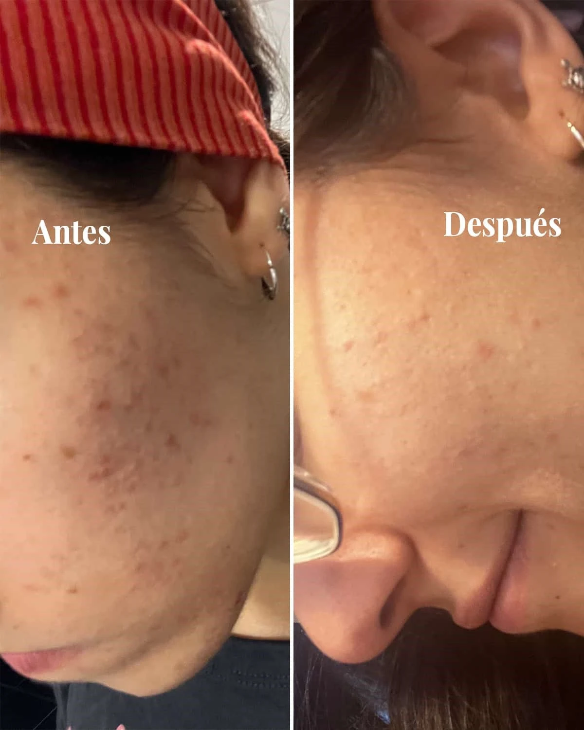 Sérum Iluminador Antimanchas 8 Sérum Iluminador Antimanchas - Image 6