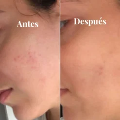 Sérum Iluminador Antimanchas 14 Sérum Iluminador Antimanchas -Cliomakeup Shop Serumiluminadorantimanchas 02