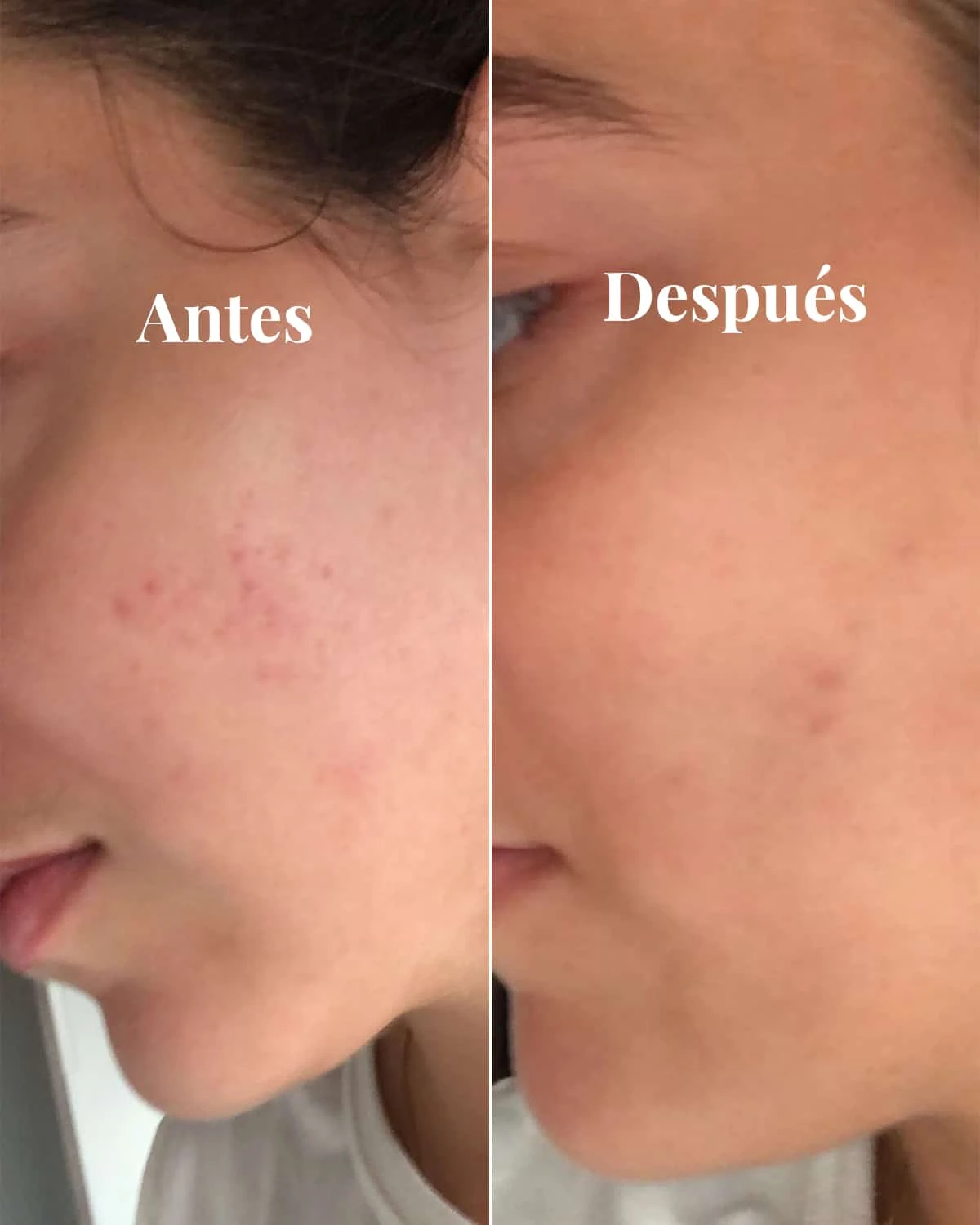 Sérum Iluminador Antimanchas 7 Sérum Iluminador Antimanchas - Image 5